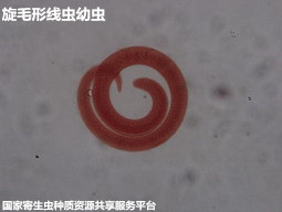 16-2旋毛形线虫幼虫.jpg