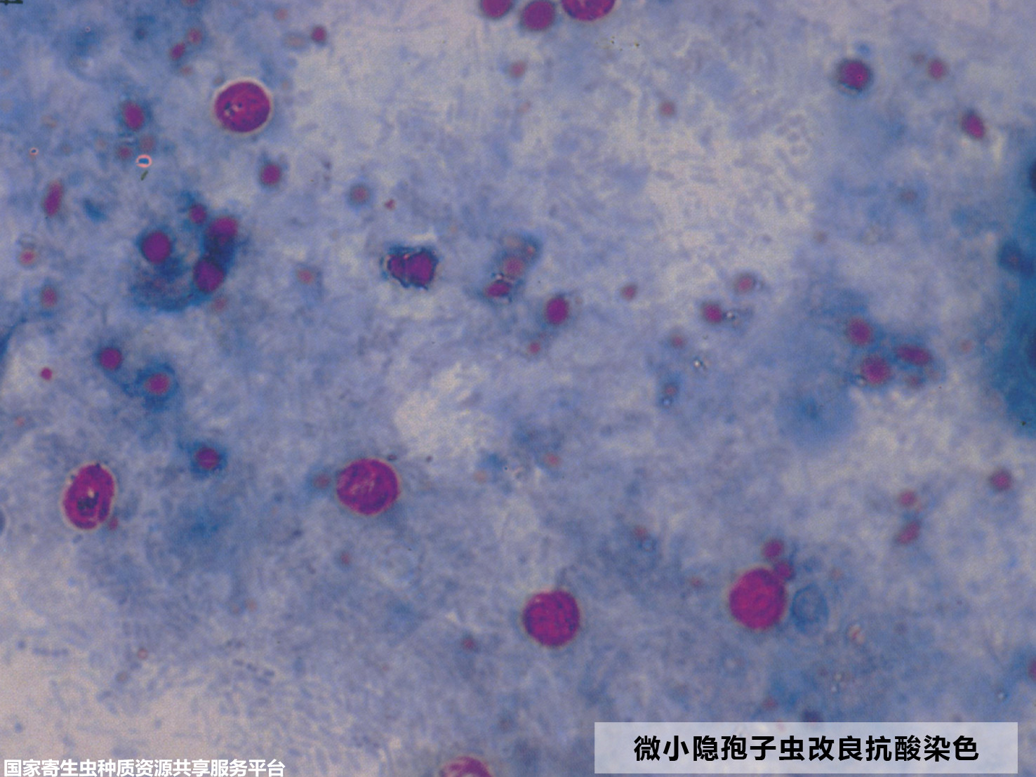 11-3微小隐孢子虫改良抗酸染色.jpg