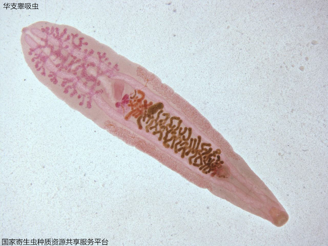 21-3华支睾吸虫成虫.jpg