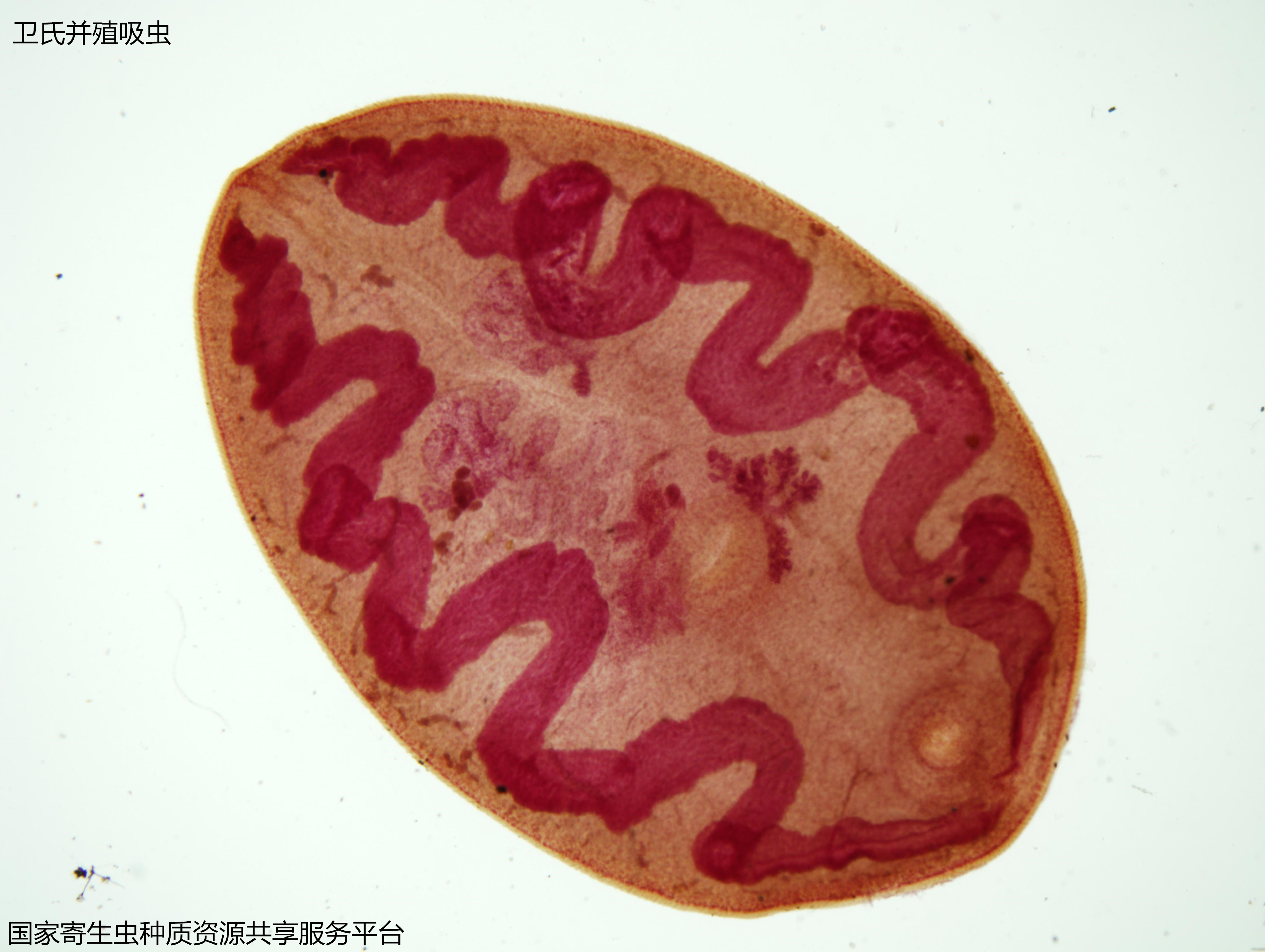 21-2卫氏并殖吸虫.jpg