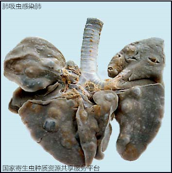 21-1肺吸虫感染肺.jpg