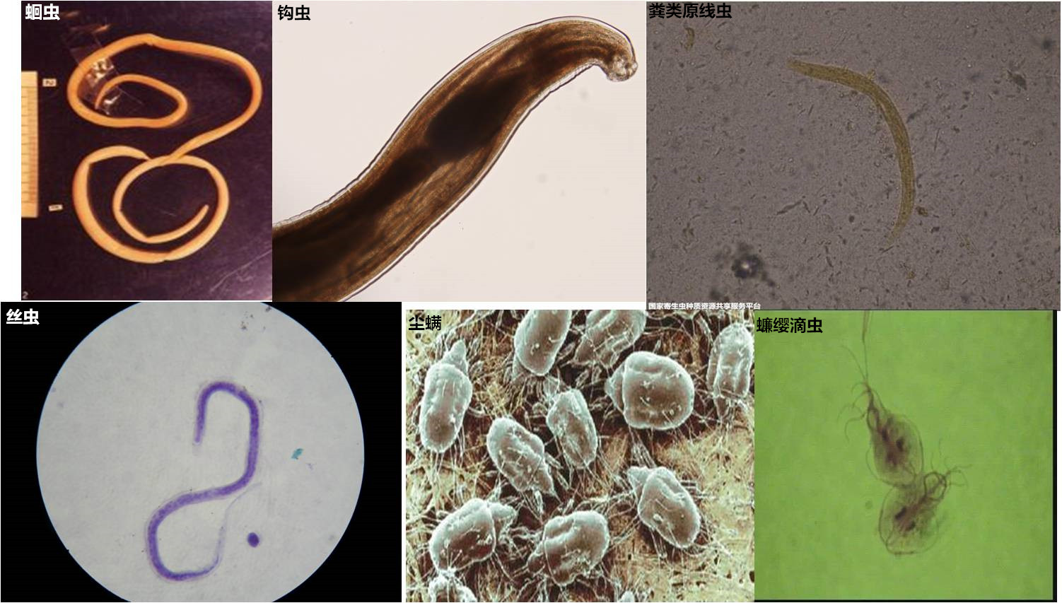 各类寄生虫的图片图片